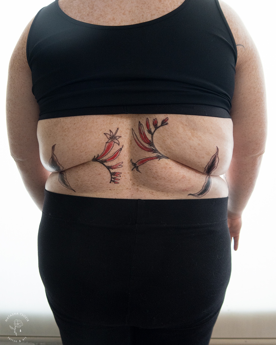 Expert Surgical Tattoo Removal | From £595 | UKSKIN